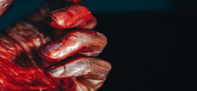 Representational Photo